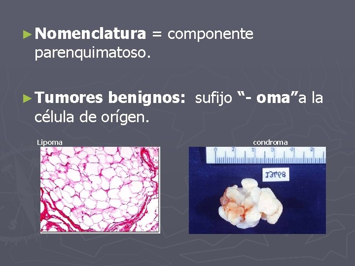 ► Nomenclatura = componente parenquimatoso. ► Tumores benignos: sufijo “- oma”a la célula de