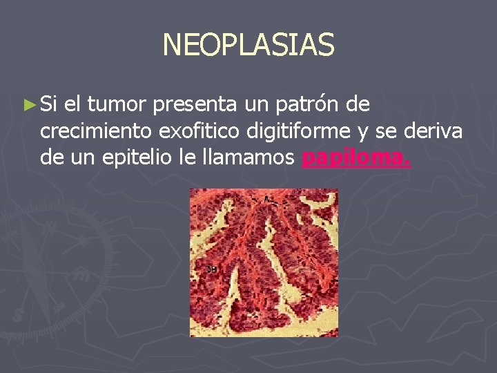 NEOPLASIAS ► Si el tumor presenta un patrón de crecimiento exofitico digitiforme y se