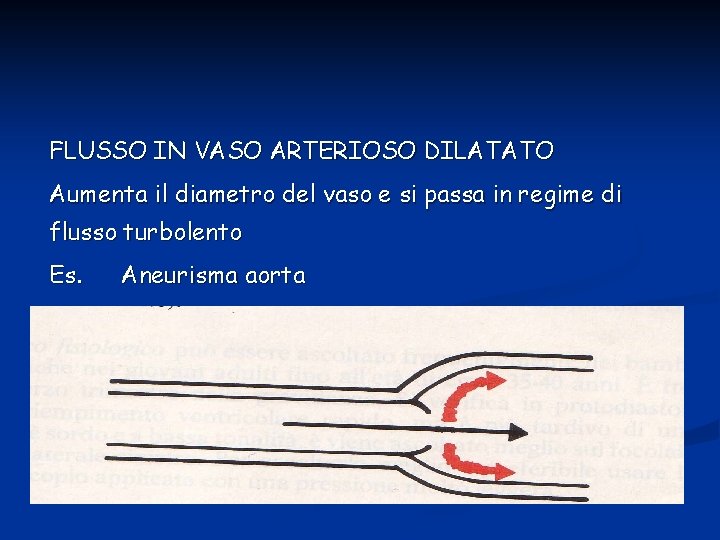 FLUSSO IN VASO ARTERIOSO DILATATO Aumenta il diametro del vaso e si passa in