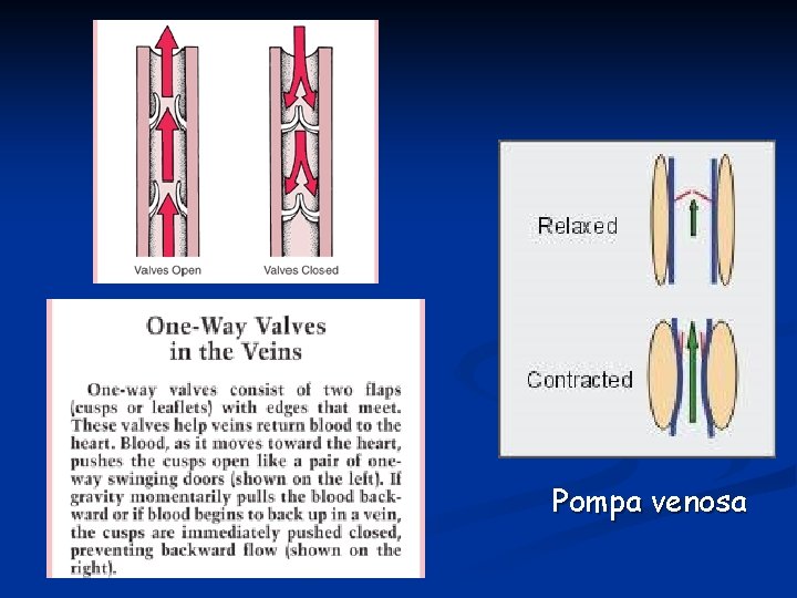 Pompa venosa 