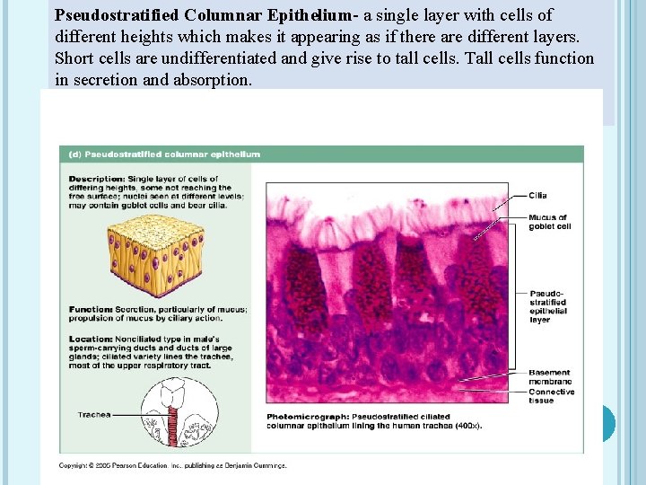 Pseudostratified Columnar Epithelium- a single layer with cells of different heights which makes it