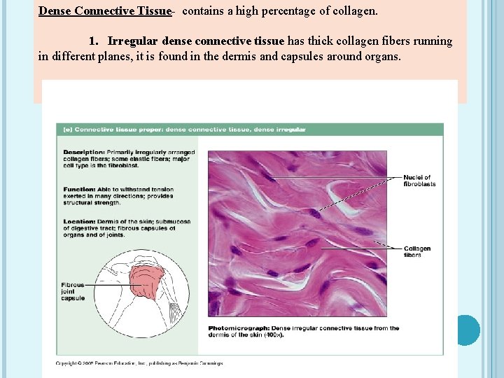 Dense Connective Tissue- contains a high percentage of collagen. 1. Irregular dense connective tissue