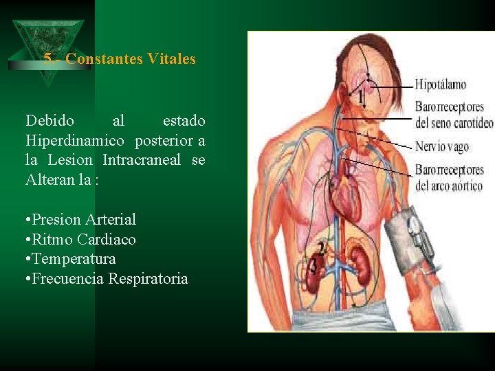 5. - Constantes Vitales Debido al estado Hiperdinamico posterior a la Lesion Intracraneal se