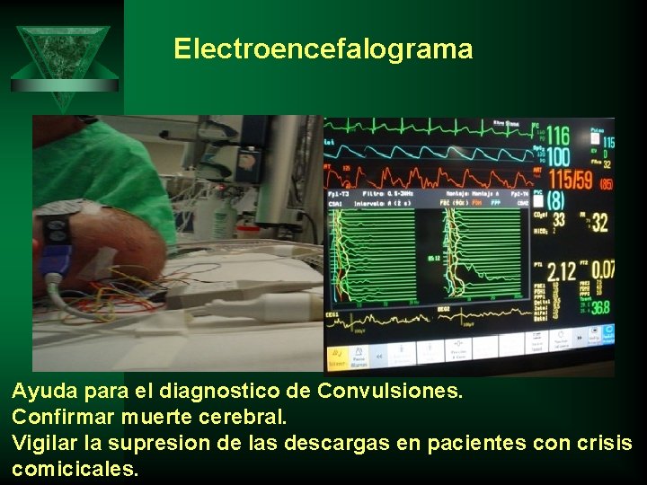 Electroencefalograma Ayuda para el diagnostico de Convulsiones. Confirmar muerte cerebral. Vigilar la supresion de