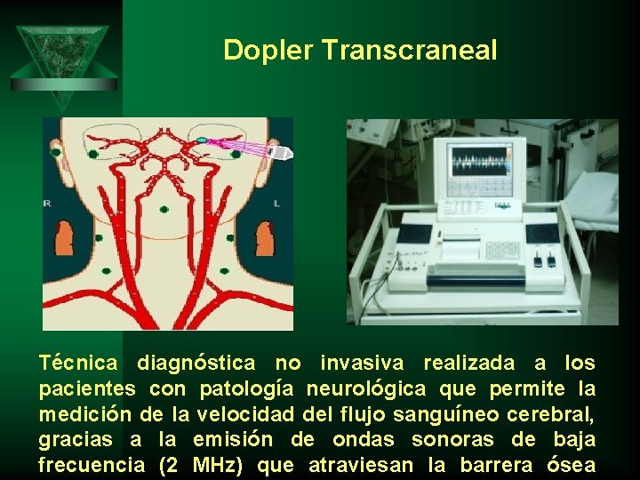 Dopler Transcraneal Técnica diagnóstica no invasiva realizada a los pacientes con patología neurológica que