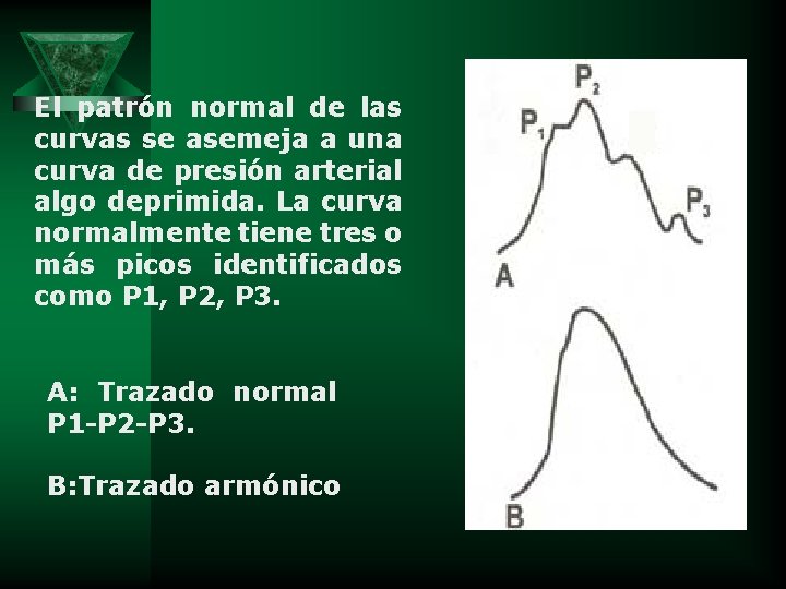 El patrón normal de las curvas se asemeja a una curva de presión arterial