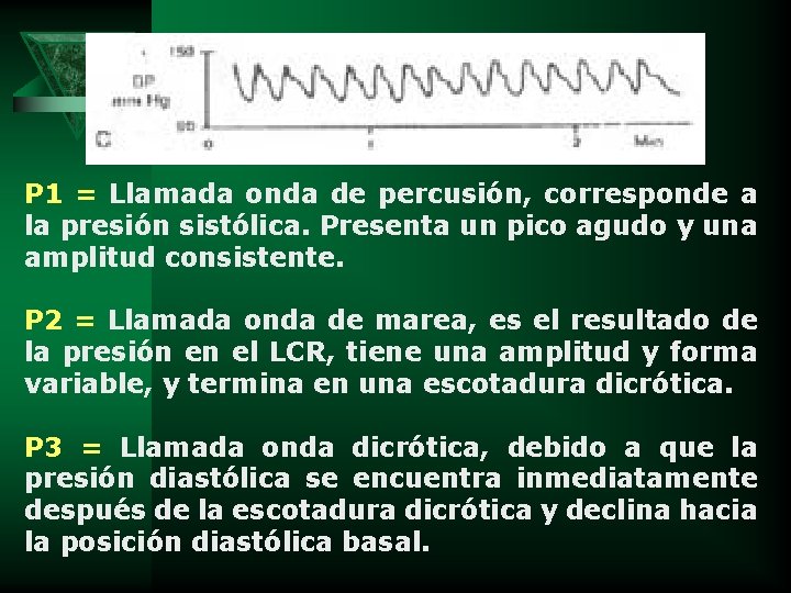 P 1 = Llamada onda de percusión, corresponde a la presión sistólica. Presenta un