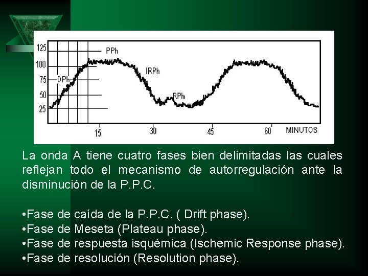 La onda A tiene cuatro fases bien delimitadas las cuales reflejan todo el mecanismo