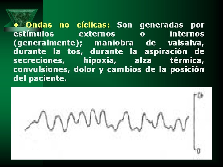  • Ondas no cíclicas: Son generadas por estímulos externos o internos (generalmente); maniobra