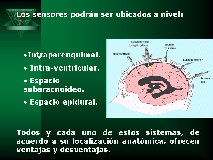 Los sensores podrán ser ubicados a nivel: • Intraparenquimal. • • Intra-ventricular. • Espacio