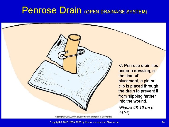 Penrose Drain (OPEN DRAINAGE SYSTEM) • A Penrose drain lies under a dressing; at Penrose Drain (OPEN DRAINAGE SYSTEM) • A Penrose drain lies under a dressing; at