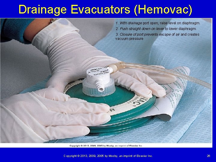 Drainage Evacuators (Hemovac) 1. With drainage port open, raise level on diaphragm. 2. Push Drainage Evacuators (Hemovac) 1. With drainage port open, raise level on diaphragm. 2. Push