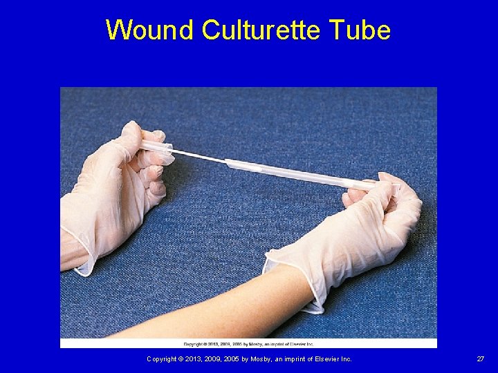 Wound Culturette Tube Copyright © 2013, 2009, 2005 by Mosby, an imprint of Elsevier Wound Culturette Tube Copyright © 2013, 2009, 2005 by Mosby, an imprint of Elsevier