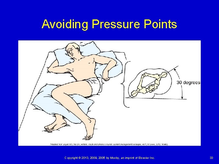 Avoiding Pressure Points Copyright © 2013, 2009, 2005 by Mosby, an imprint of Elsevier Avoiding Pressure Points Copyright © 2013, 2009, 2005 by Mosby, an imprint of Elsevier