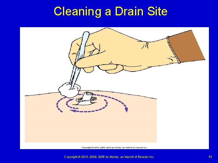 Cleaning a Drain Site Copyright © 2013, 2009, 2005 by Mosby, an imprint of Cleaning a Drain Site Copyright © 2013, 2009, 2005 by Mosby, an imprint of