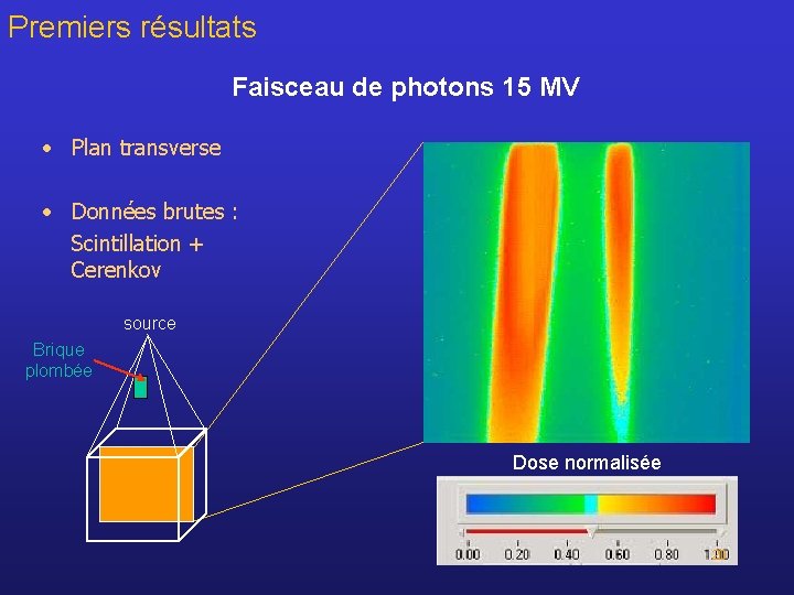 Premiers résultats Faisceau de photons 15 MV • Plan transverse • Données brutes :