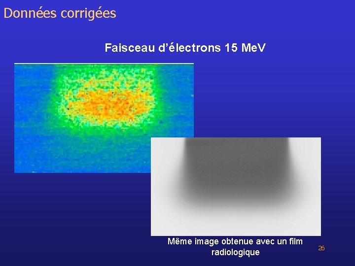 Données corrigées Faisceau d’électrons 15 Me. V Même image obtenue avec un film radiologique