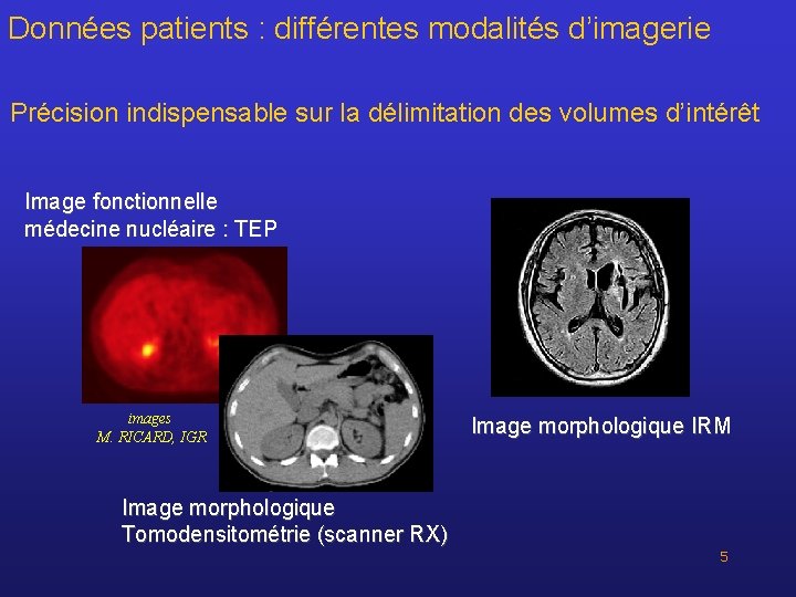 Données patients : différentes modalités d’imagerie Précision indispensable sur la délimitation des volumes d’intérêt