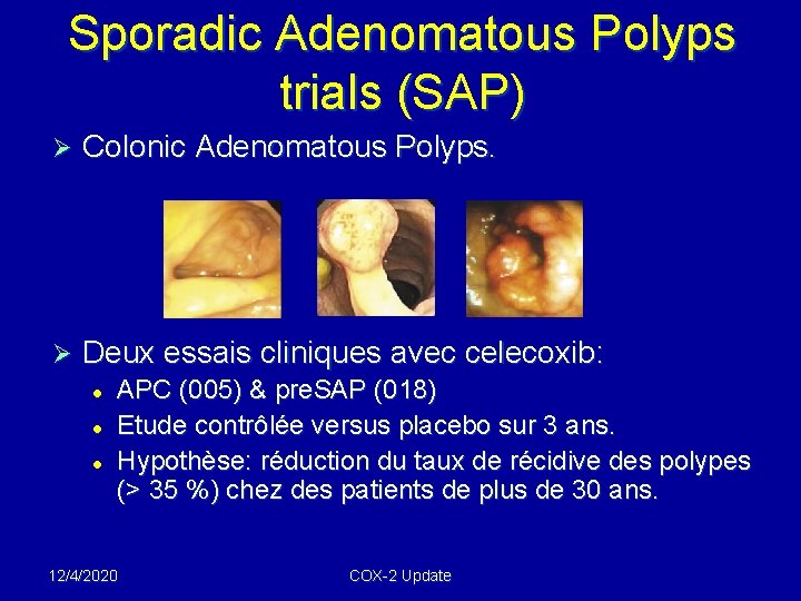 Sporadic Adenomatous Polyps trials (SAP) Ø Colonic Adenomatous Polyps. Ø Deux essais cliniques avec