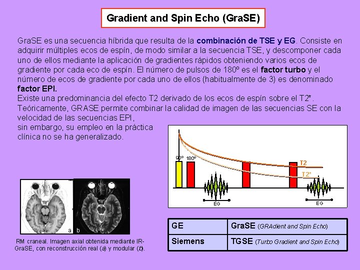 Gradient and Spin Echo (Gra. SE) Gra. SE es una secuencia híbrida que resulta