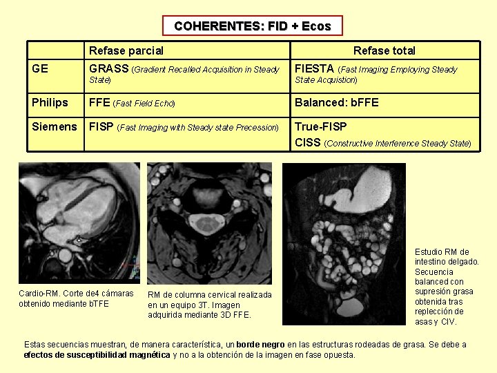 COHERENTES: FID + Ecos Refase parcial GE Refase total GRASS (Gradient Recalled Acquisition in