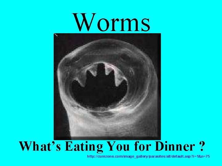 Worms What’s Eating You for Dinner ? http: //curezone. com/image_gallery/parasites/all/default. asp? i=1&n=75 