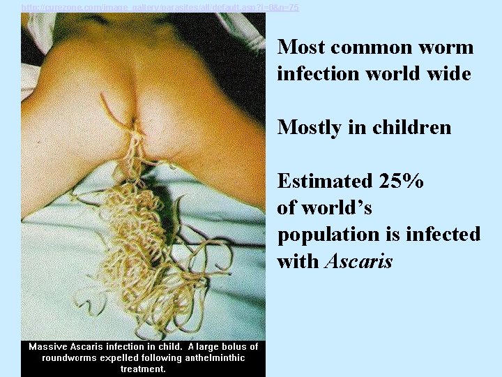 http: //curezone. com/image_gallery/parasites/all/default. asp? i=0&n=75 Most common worm infection world wide Mostly in children