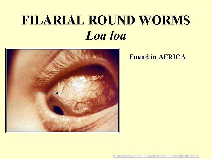 FILARIAL ROUND WORMS Loa loa Found in AFRICA http: //www. biosci. ohio-state. edu/~parasite/loa. html