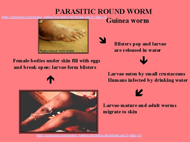 PARASITIC ROUND WORM http: //curezone. com/image_gallery/parasites/all/default. asp? i=5&n=75 Guinea worm Female bodies under skin