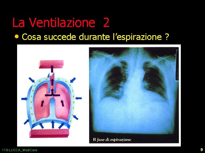 La Ventilazione 2 • Cosa succede durante l’espirazione ? 118 -LUCCA_Medi. Care 9 