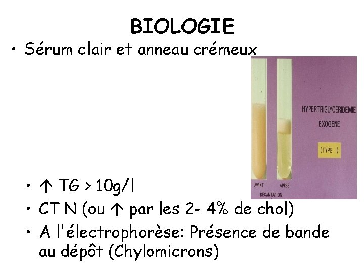 BIOLOGIE • Sérum clair et anneau crémeux • TG > 10 g/l • CT
