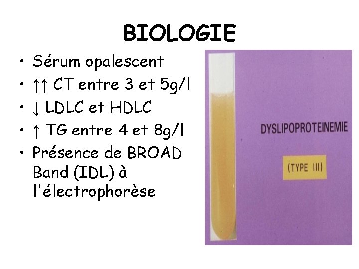 BIOLOGIE • • • Sérum opalescent ↑↑ CT entre 3 et 5 g/l ↓