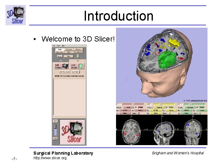 Introduction • Welcome to 3 D Slicer! Surgical Planning Laboratory -1 - http: //www. Introduction • Welcome to 3 D Slicer! Surgical Planning Laboratory -1 - http: //www.