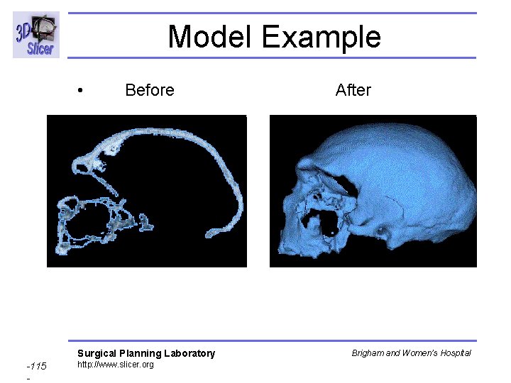 Model Example • Before After Surgical Planning Laboratory -115 - http: //www. slicer. org Model Example • Before After Surgical Planning Laboratory -115 - http: //www. slicer. org