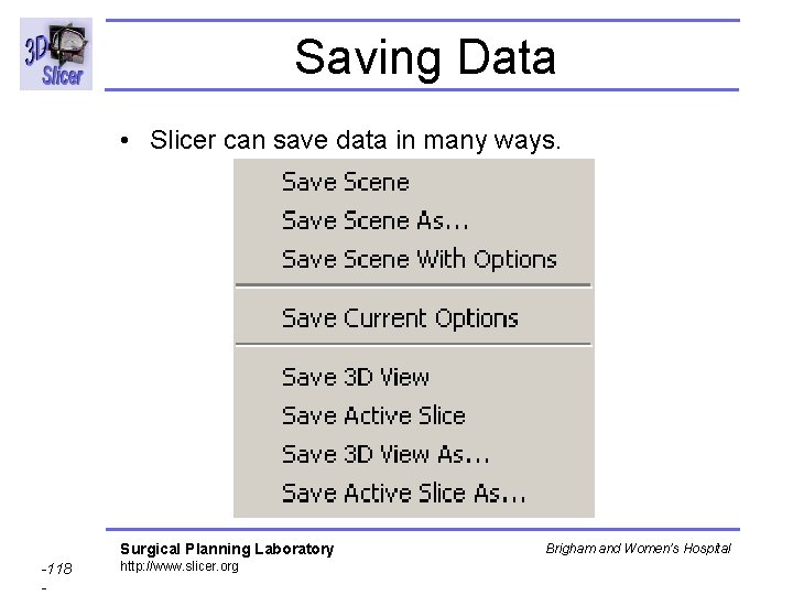 Saving Data • Slicer can save data in many ways. Surgical Planning Laboratory -118 Saving Data • Slicer can save data in many ways. Surgical Planning Laboratory -118
