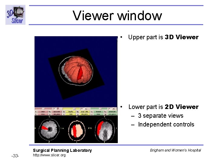 Viewer window • Upper part is 3 D Viewer • Lower part is 2 Viewer window • Upper part is 3 D Viewer • Lower part is 2
