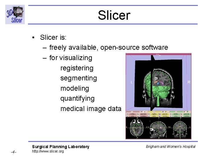 Slicer • Slicer is: – freely available, open-source software – for visualizing registering segmenting Slicer • Slicer is: – freely available, open-source software – for visualizing registering segmenting