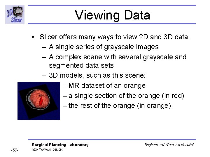 Viewing Data • Slicer offers many ways to view 2 D and 3 D Viewing Data • Slicer offers many ways to view 2 D and 3 D