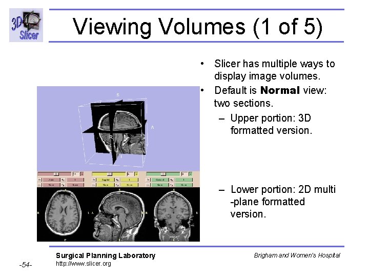 Viewing Volumes (1 of 5) • Slicer has multiple ways to display image volumes. Viewing Volumes (1 of 5) • Slicer has multiple ways to display image volumes.