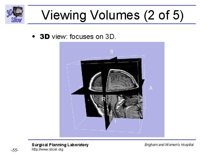 Viewing Volumes (2 of 5) • 3 D view: focuses on 3 D. Surgical Viewing Volumes (2 of 5) • 3 D view: focuses on 3 D. Surgical