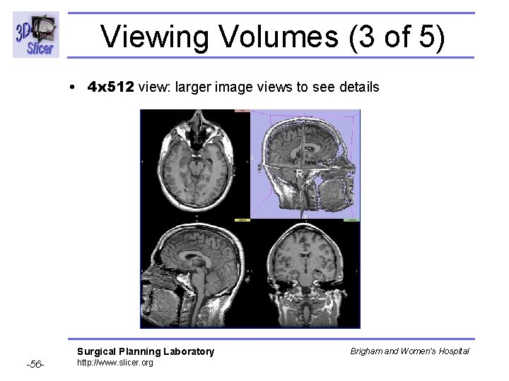 Viewing Volumes (3 of 5) • 4 x 512 view: larger image views to Viewing Volumes (3 of 5) • 4 x 512 view: larger image views to