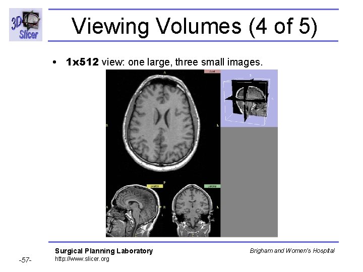 Viewing Volumes (4 of 5) • 1 x 512 view: one large, three small Viewing Volumes (4 of 5) • 1 x 512 view: one large, three small