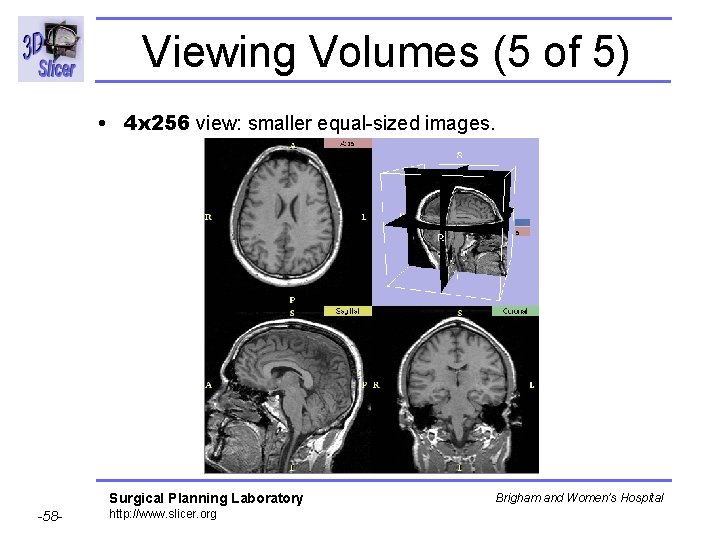 Viewing Volumes (5 of 5) • 4 x 256 view: smaller equal-sized images. Surgical Viewing Volumes (5 of 5) • 4 x 256 view: smaller equal-sized images. Surgical