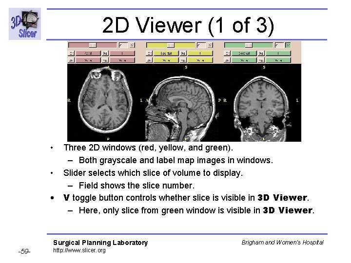 2 D Viewer (1 of 3) • Three 2 D windows (red, yellow, and 2 D Viewer (1 of 3) • Three 2 D windows (red, yellow, and