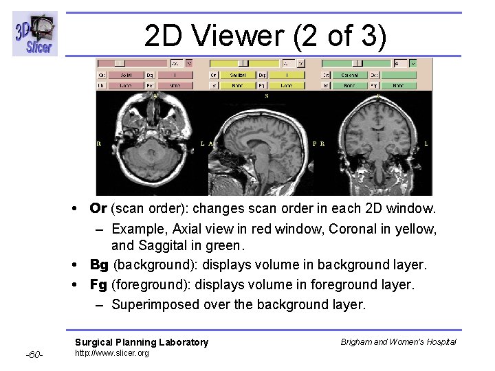 2 D Viewer (2 of 3) • Or (scan order): changes scan order in 2 D Viewer (2 of 3) • Or (scan order): changes scan order in