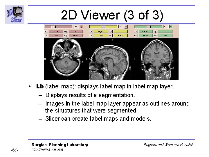 2 D Viewer (3 of 3) • Lb (label map): displays label map in 2 D Viewer (3 of 3) • Lb (label map): displays label map in