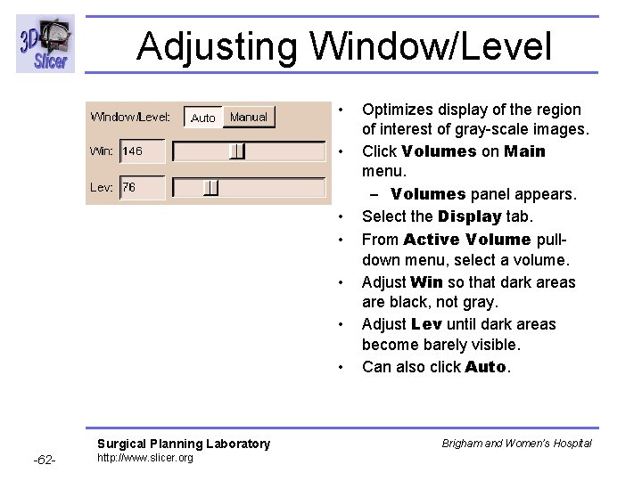 Adjusting Window/Level • • Surgical Planning Laboratory -62 - http: //www. slicer. org Optimizes Adjusting Window/Level • • Surgical Planning Laboratory -62 - http: //www. slicer. org Optimizes