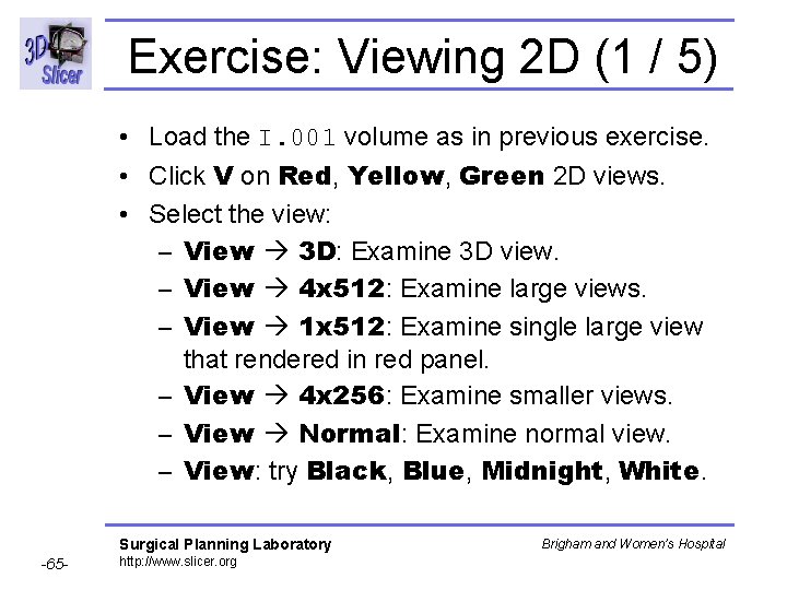 Exercise: Viewing 2 D (1 / 5) • Load the I. 001 volume as Exercise: Viewing 2 D (1 / 5) • Load the I. 001 volume as
