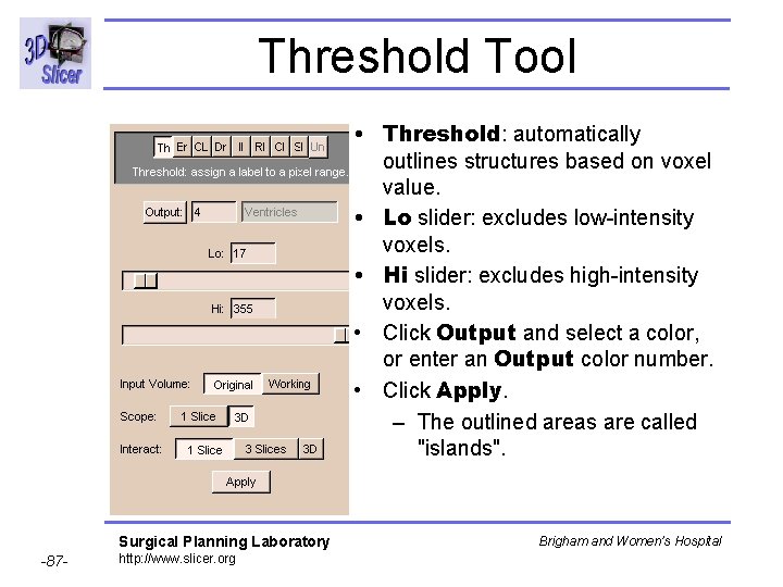 Threshold Tool • Threshold: automatically outlines structures based on voxel value. • Lo slider: Threshold Tool • Threshold: automatically outlines structures based on voxel value. • Lo slider: