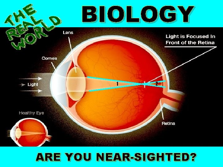 BIOLOGY 1 2 ARE YOU NEAR-SIGHTED? BIOLOGY 1 2 ARE YOU NEAR-SIGHTED?